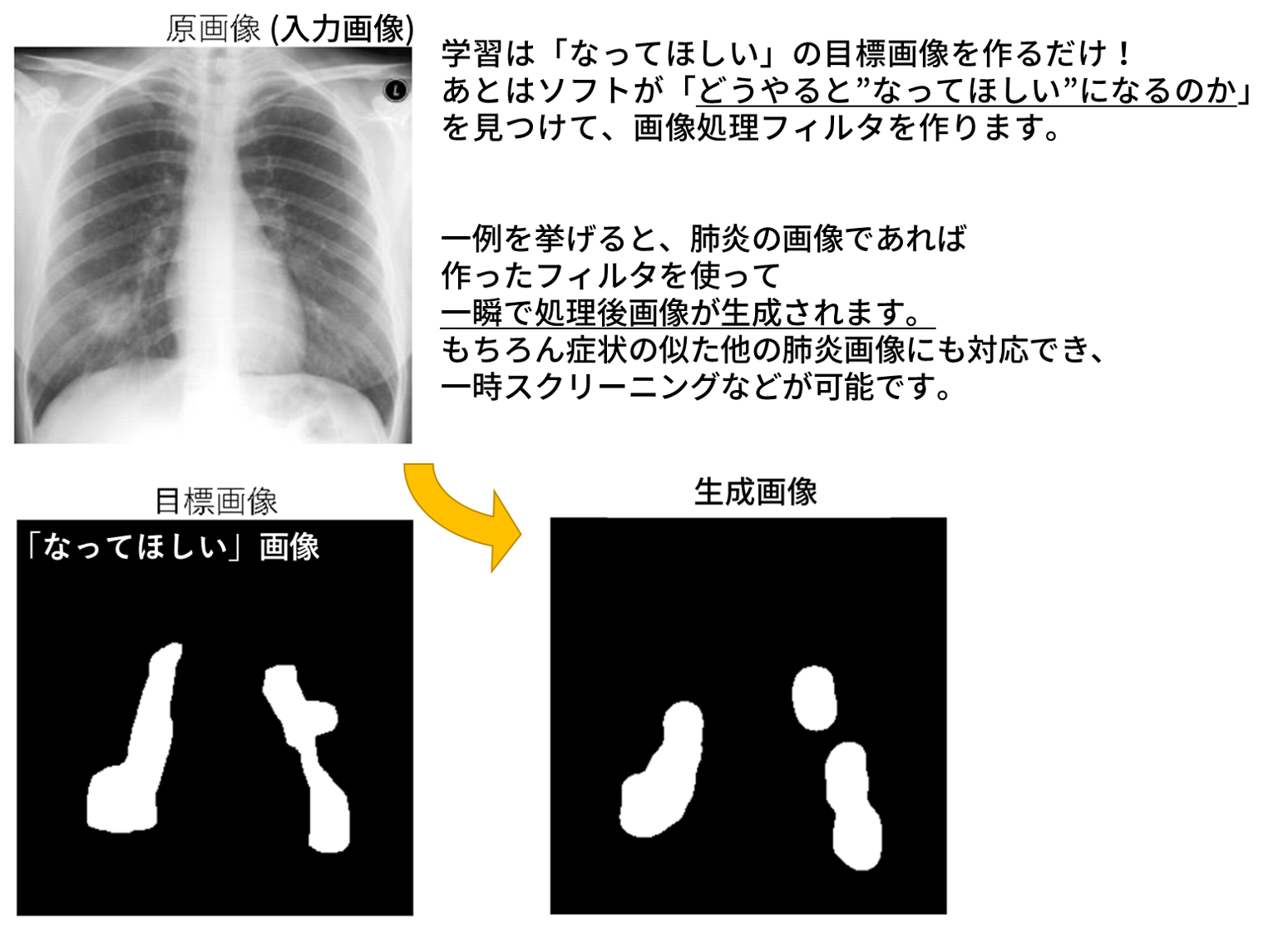 事例